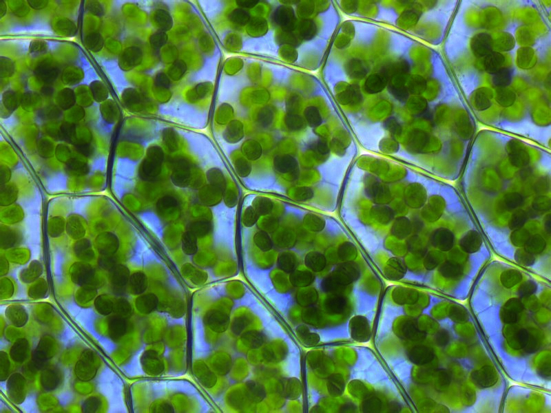 Plant cells viewed under a microscope, revealing dozens of green, chlorophyll-dense chloroplasts where the reactions of photosynthesis occur.