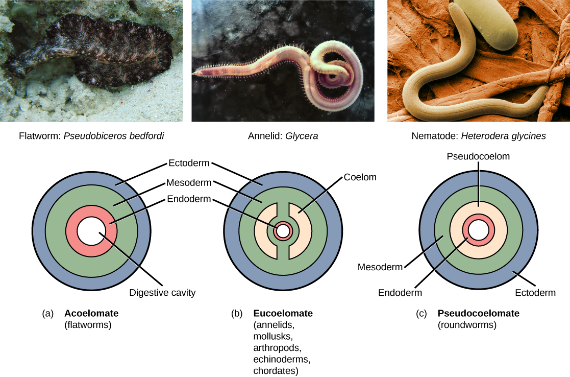 Cross-sections comparing acoelomate, pseudocoelomate, and eucoelomate body plans, highlighting the architecture of fluid-filled cavities relative to the digestive tract and outer body wall.