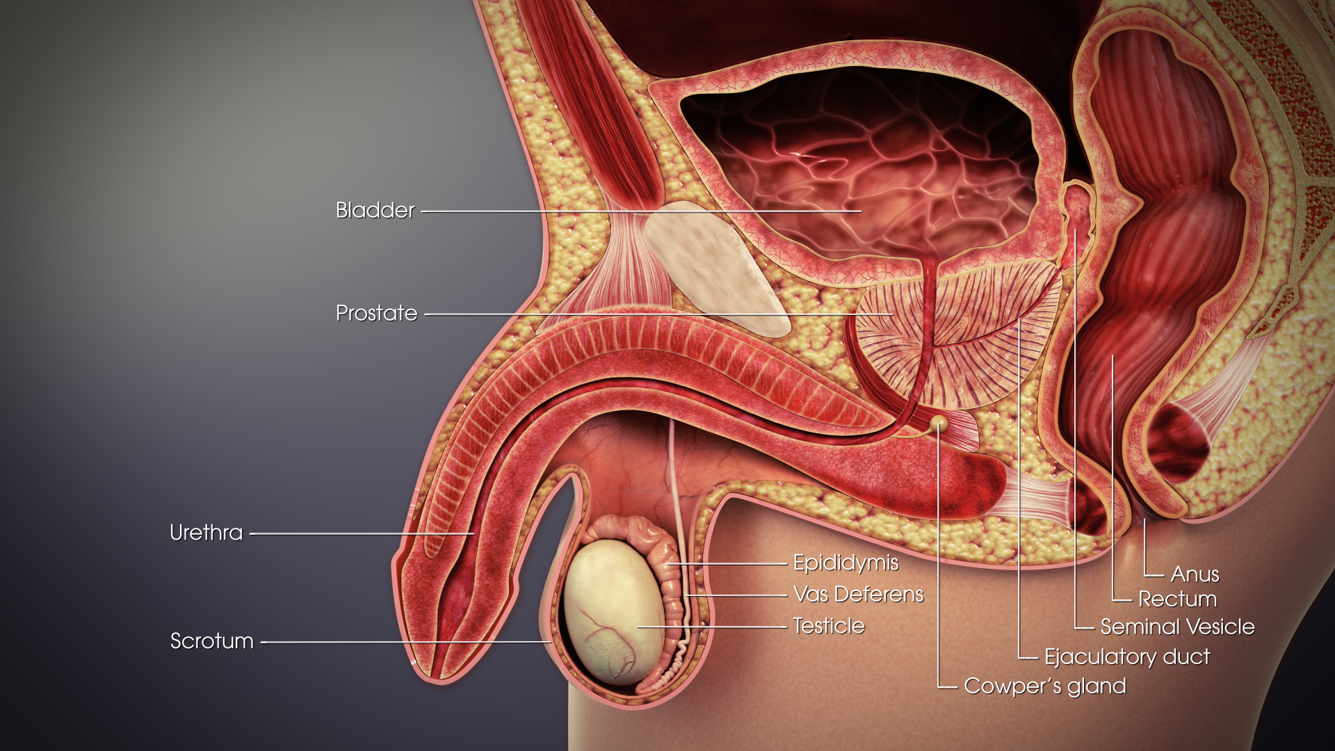 A vasectomy severs the vas deferens to prevent sperm from entering the ejaculate. However, viable sperm remain in the distal tract, necessitating alternate contraception until a semen analysis confirms complete azoospermia.