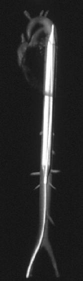 An intra-aortic balloon pump. Operating highly specialized or invasive equipment in Dubai requires both documented formal training and current, demonstrated clinical competency.