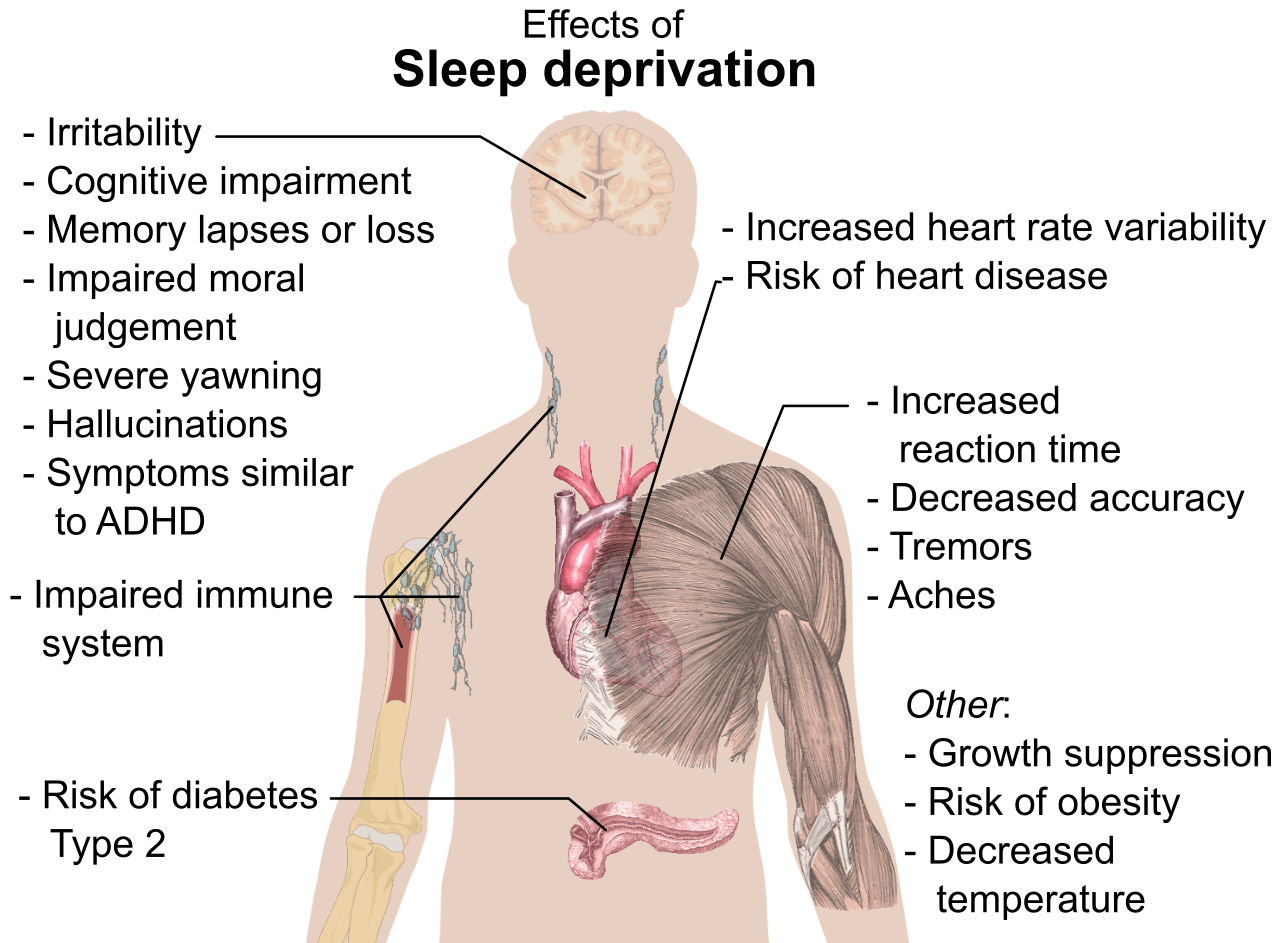 Systemic physiological consequences of chronic sleep deprivation, highlighting its widespread impact on multiple organ systems.