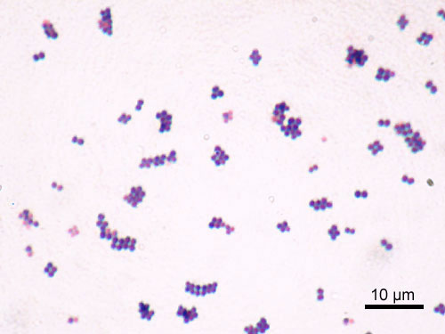 A Gram stain of Staphylococcus aureus, demonstrating how binomial nomenclature is used to identify the specific cellular pathogens involved in a clinical infection.
