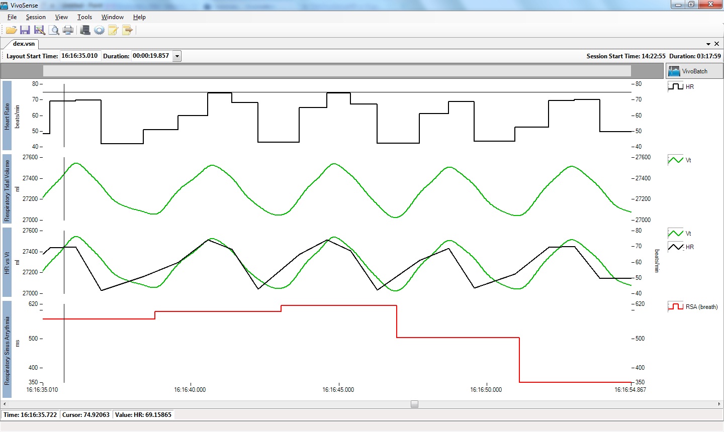 A clinical line graph tracking patient heart rate and lung volume over time. The continuous lines reveal dynamic physiological trends and rates of change.