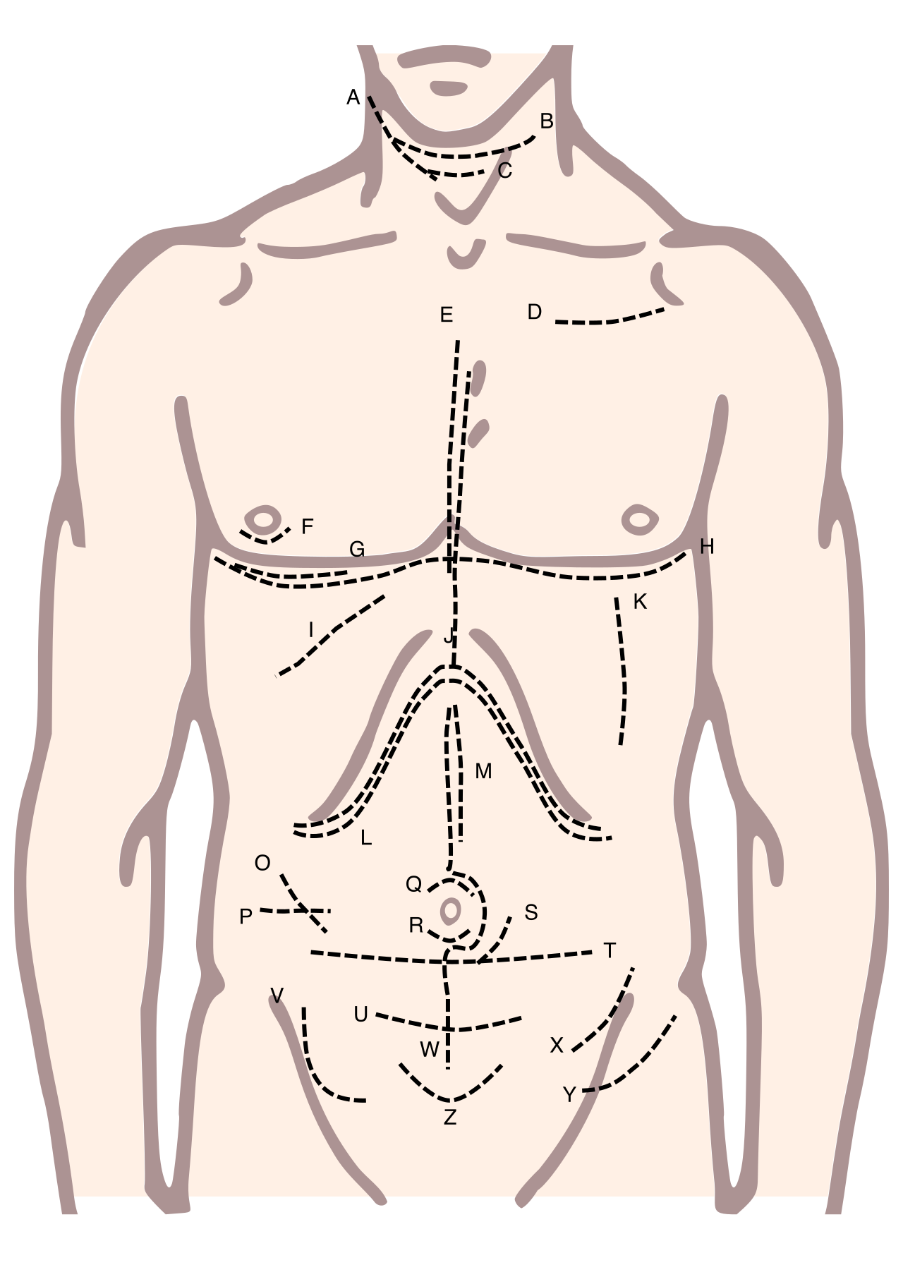 Diagram outlining various surgical incisions across the human torso. Making a surgical incision is an advanced medical intervention that strictly falls outside a registered nurse's scope of practice.