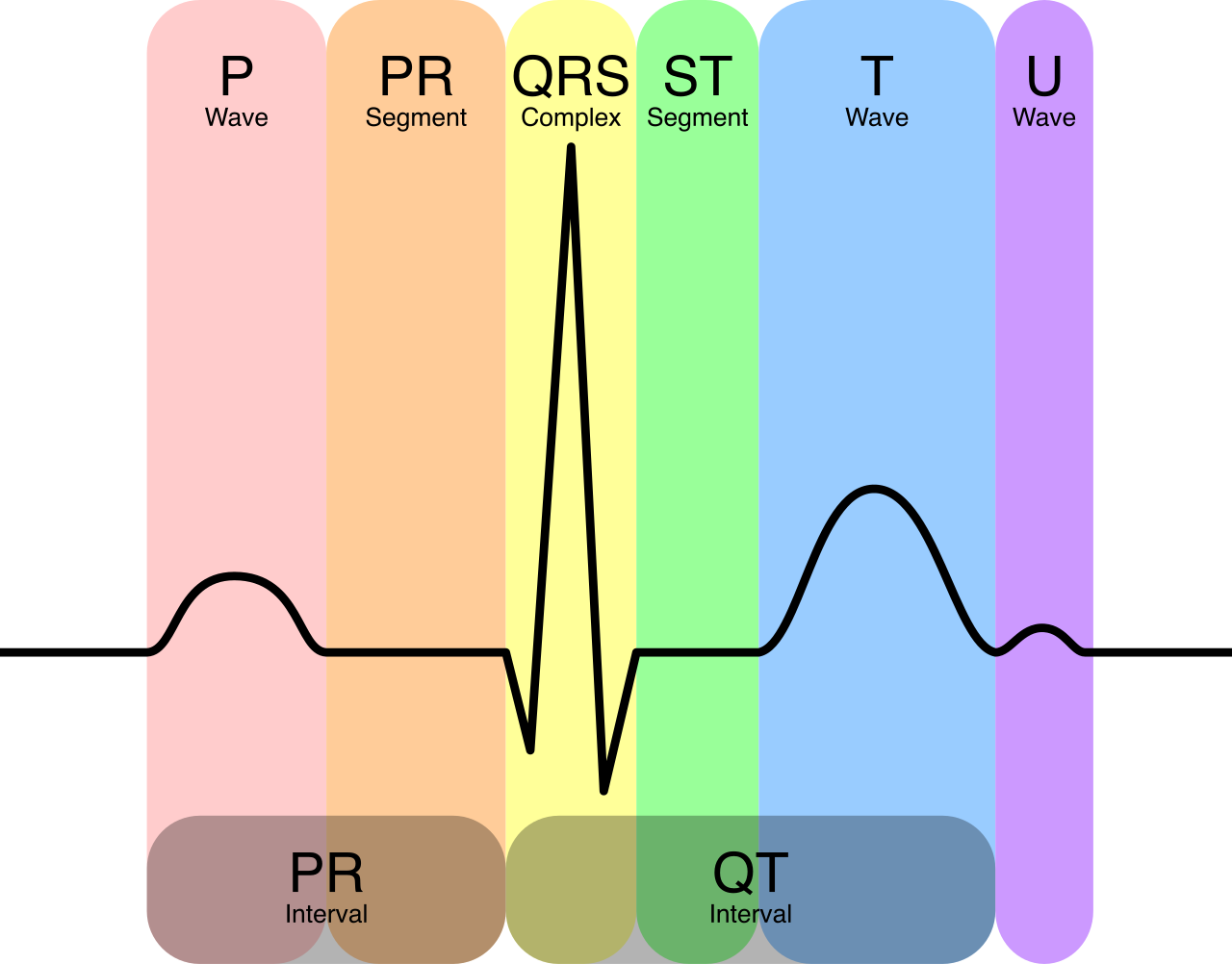 Schematic representation of a normal ECG complex. The T wave represents ventricular repolarization, a phase of the cardiac cycle that is highly sensitive to serum potassium levels.