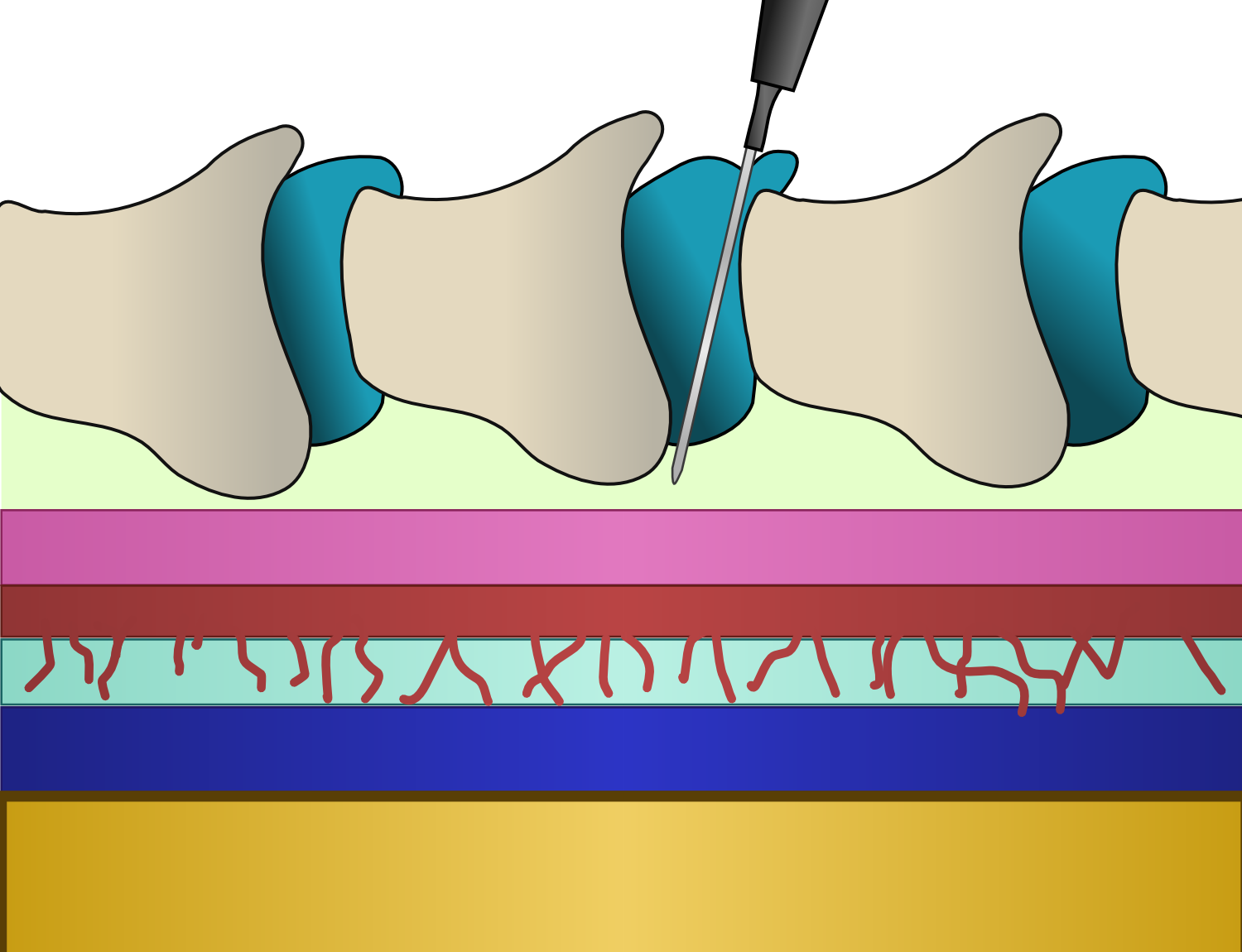 Sagittal section of the spinal column highlighting the epidural space, the target for regional anesthesia during labor.
