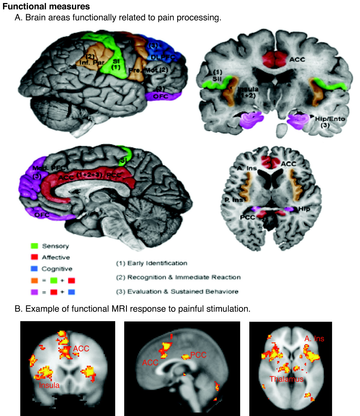 While pain originates as a biological signal processed by the cerebral cortex, a client's expression of that suffering is largely dictated by their cultural background.