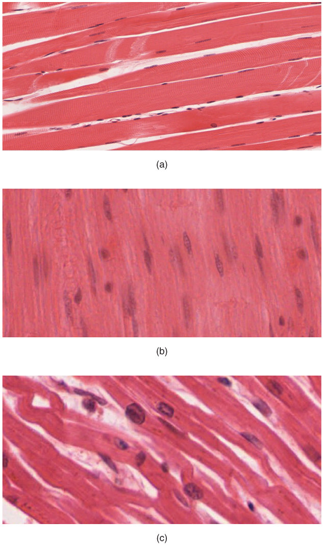 The three types of muscle tissue in the human body: skeletal (voluntary), smooth (involuntary), and cardiac (heart).