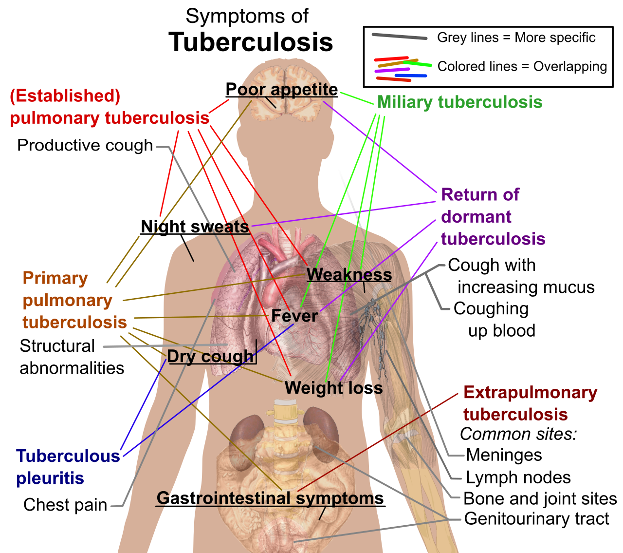 Clinical manifestations of tuberculosis across various body systems. State and federal health agencies require mandatory reporting of such communicable diseases to monitor trends and deploy targeted public health interventions.