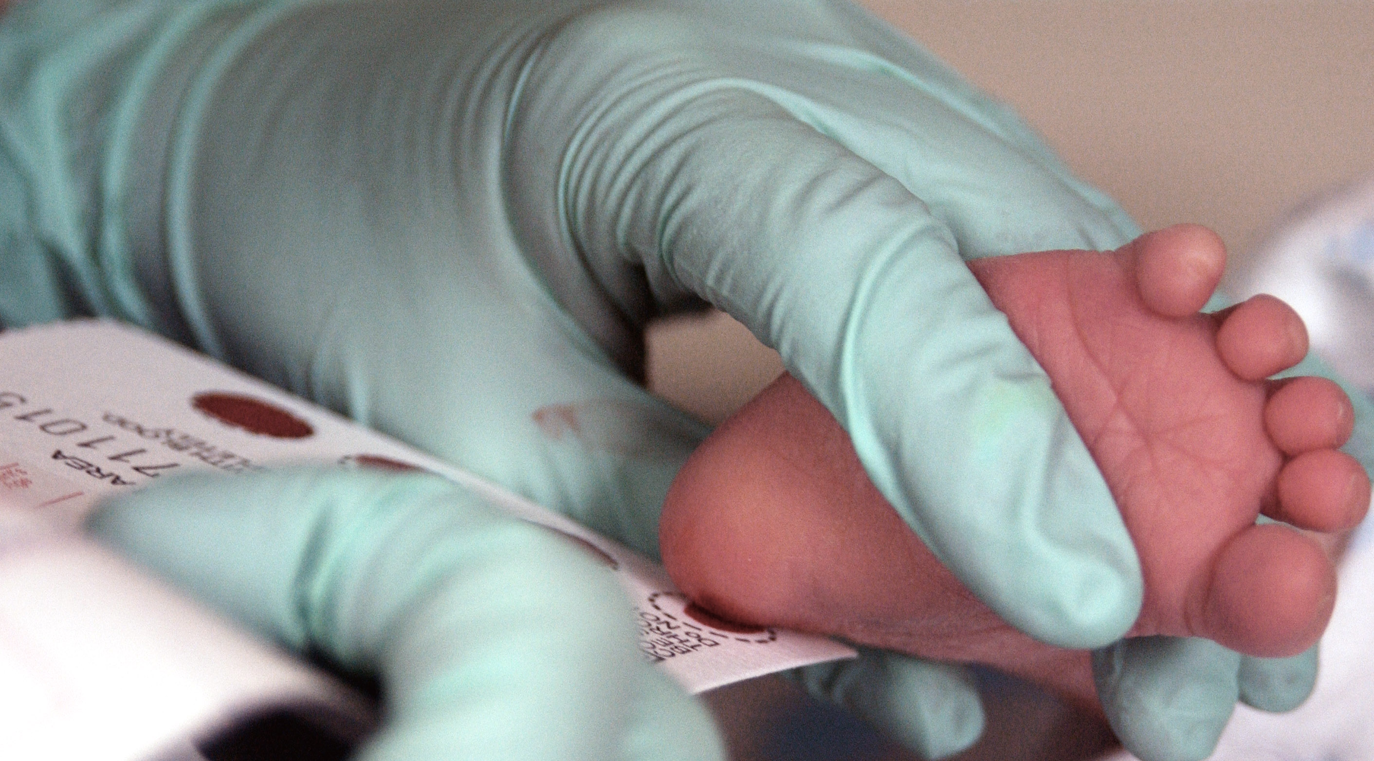 Blood collection via a neonatal heel stick, optimally performed after 24 hours of age, to screen for metabolic conditions such as Phenylketonuria.